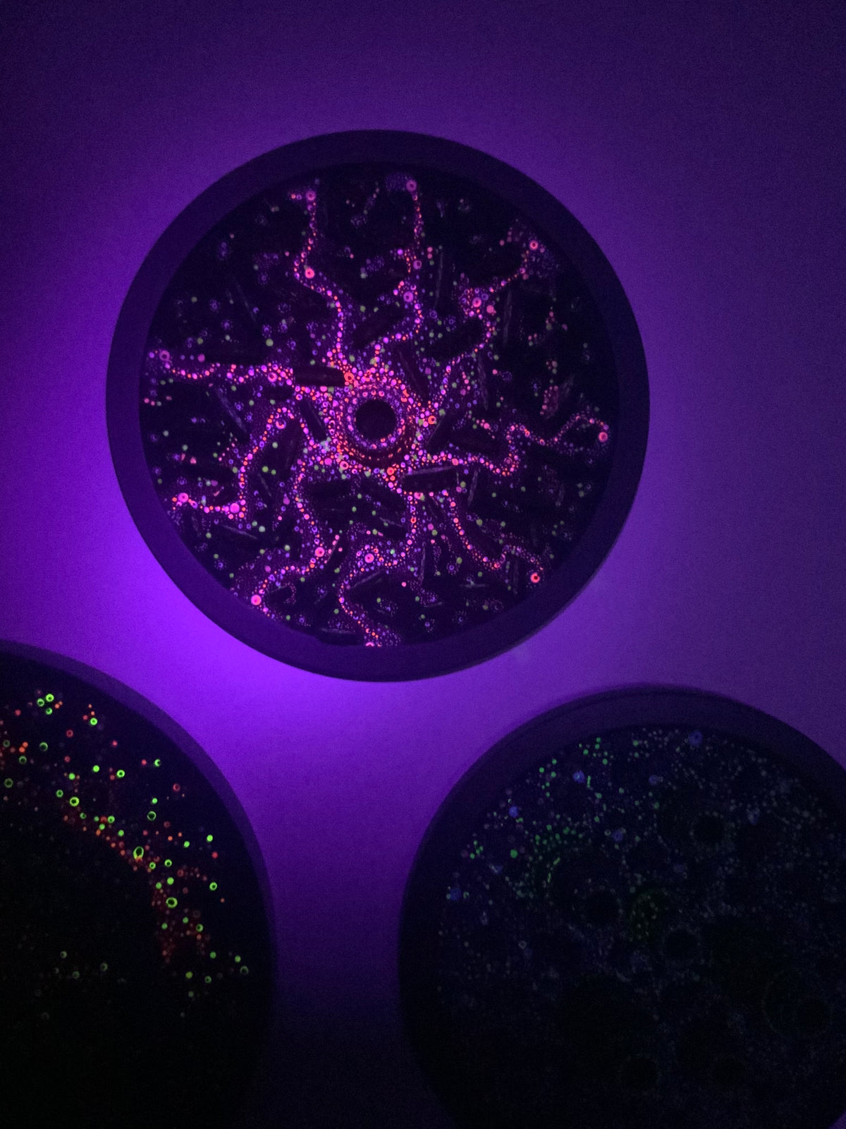 Microbiology - Serratia